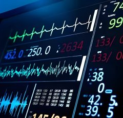 electrocardiogram