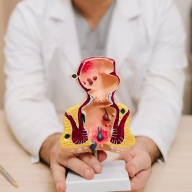 Medical rectum model with pathologies for instructional and teaching purposes